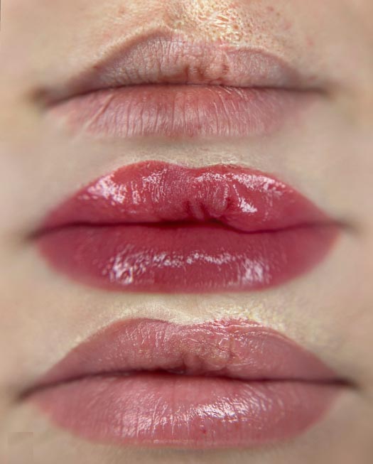 lip blushing on scar