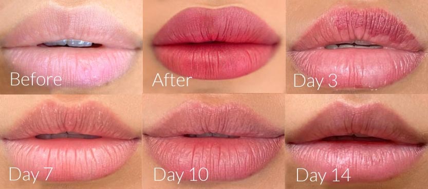 lip blushing procedure healing time pain aftercare